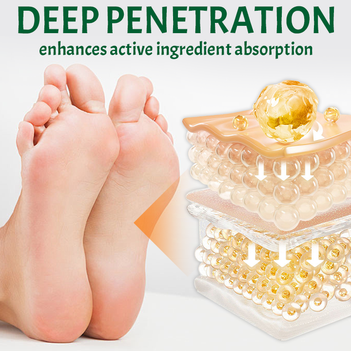 SmoothFeet Callus Remover Spray (BUY 1 GET 1 FREE + COD)