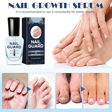 Nail Care Serum (BUY 1 GET 1 FREE + COD)