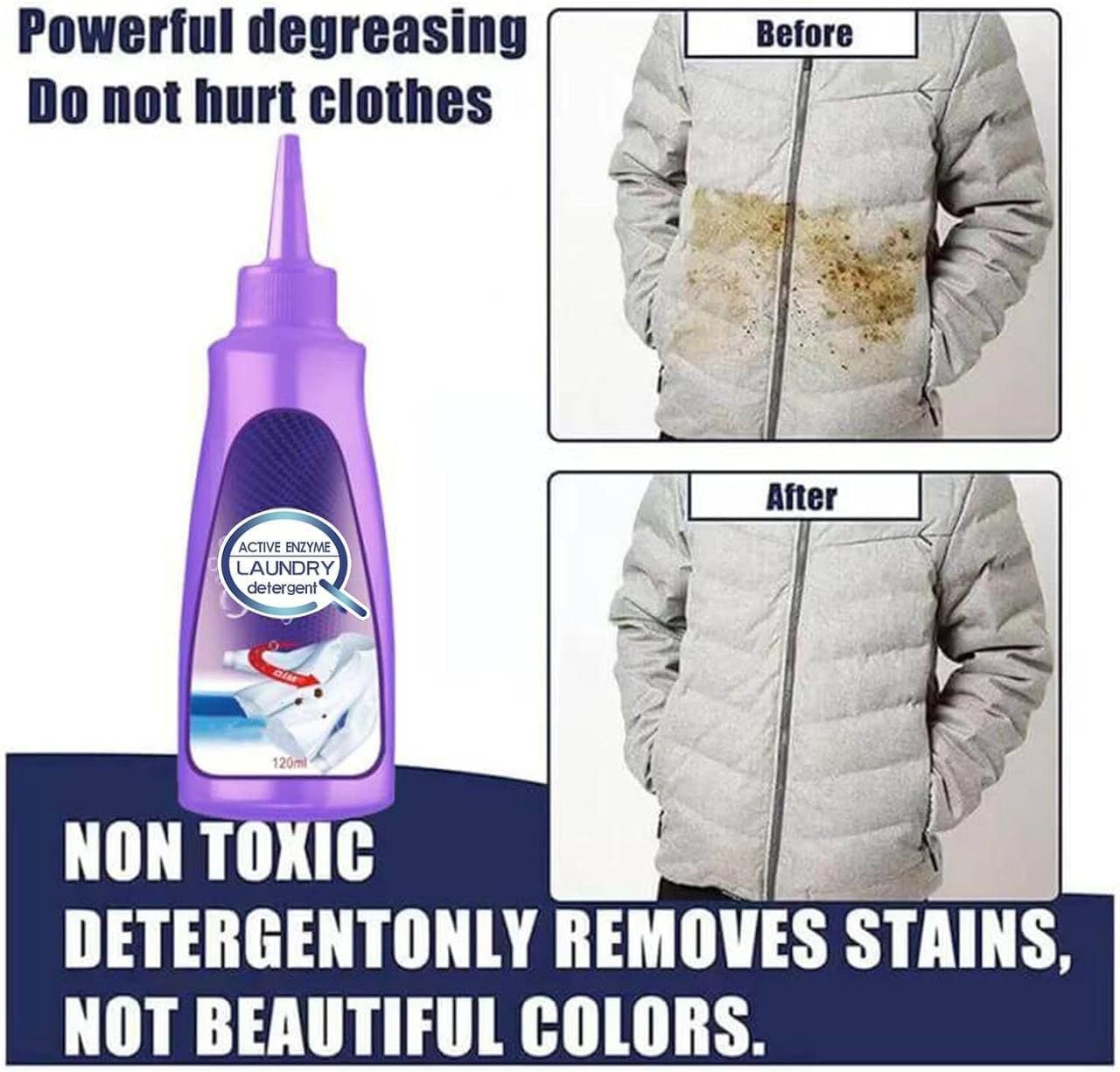 SpotGone Stain Remover - BUY 1 GET 1 FREE