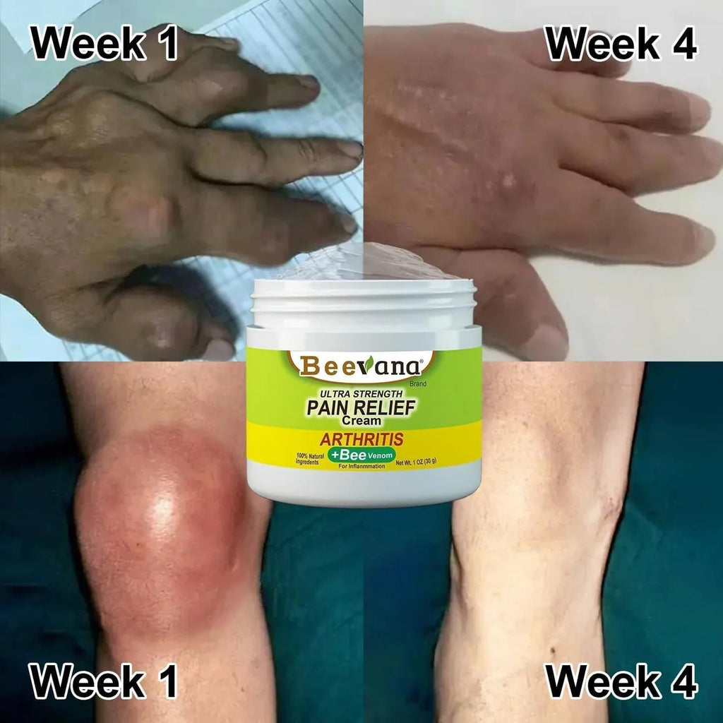 JointEase Organic BeeVenom Cream (COD Available + BUY 1 GET 2 FREE)