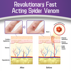 Anti-wart Skin Smoothing Spider Serum (BUY 1 GET 1 FREE + COD Available)