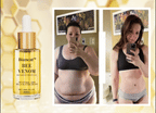 Bee Venom Metabolic Boost Oil (COD + BUY 1 GET 1)