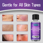 Anti-wart Skin Smoothing Spider Serum (BUY 1 GET 1 FREE + COD Available)
