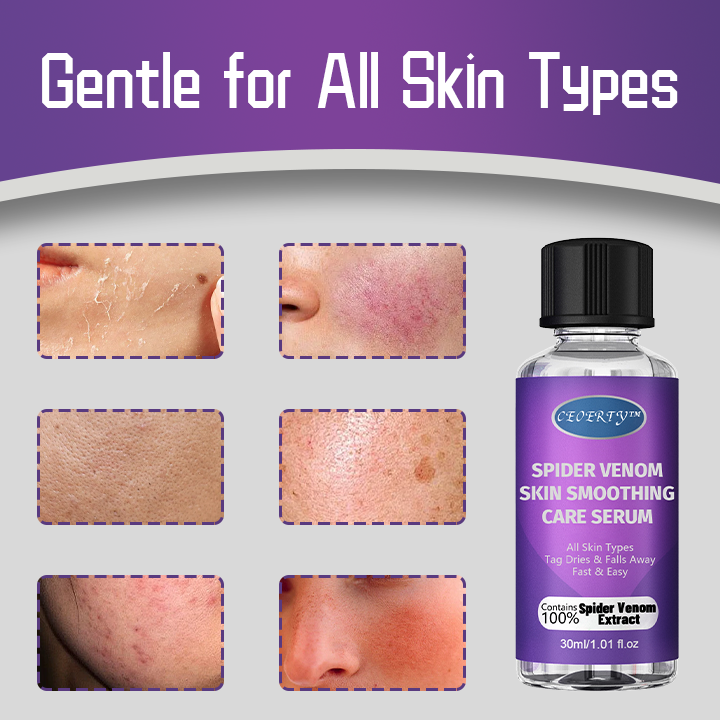 Anti-wart Skin Smoothing Spider Serum (BUY 1 GET 1 FREE + COD Available)