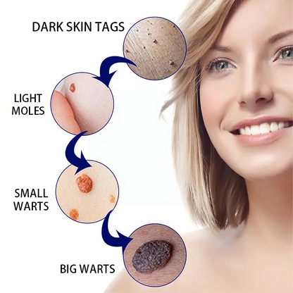 Anti-wart Skin Smoothing Spider Serum (BUY 1 GET 1 FREE + COD Available)