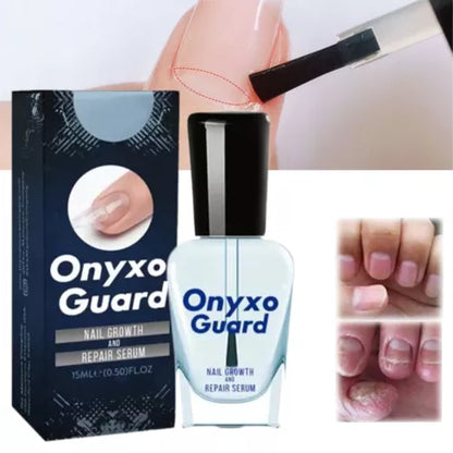 Nail Care Serum (BUY 1 GET 1 FREE + COD)